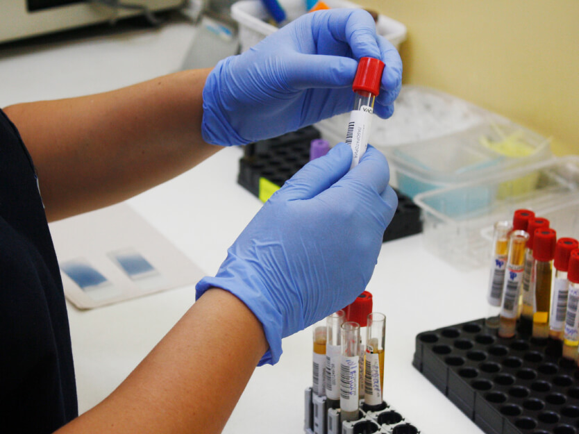 Río Grande realizará una jornada gratuita de testeos para hepatitis B y C
